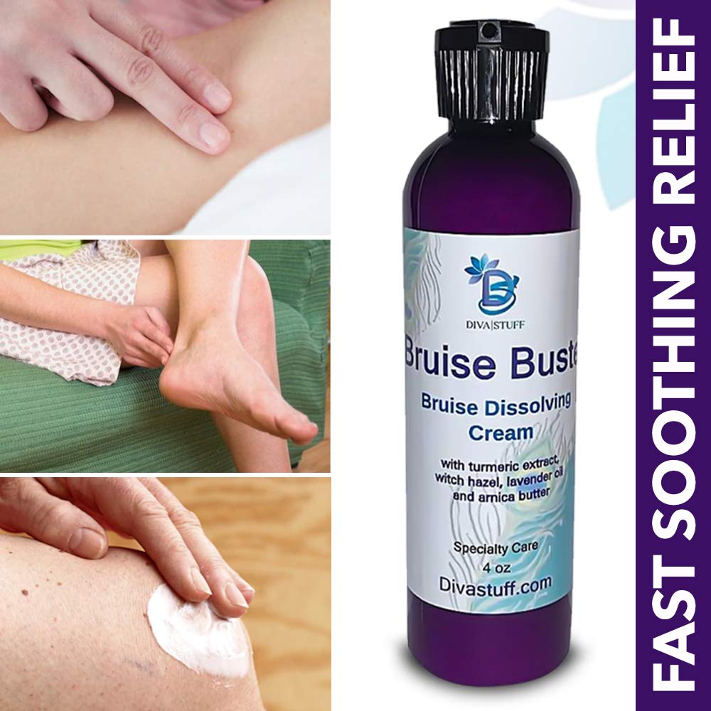 Bruise Busting Treatment Cream, For Those Who Bruise Easily